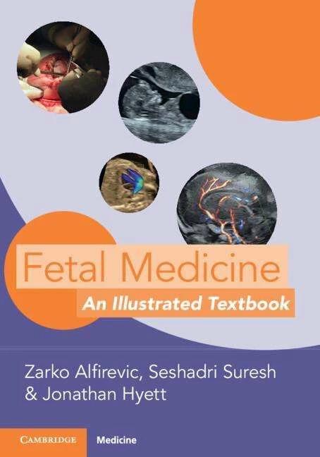 Fetal Medicine (Englisch, Jonathan Hyett, Seshadri Suresh, Zarko Alfirevic, 2023)