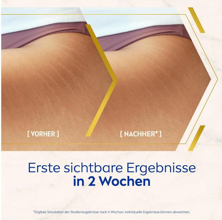Immagine prodotto NIVEA Siero Olio Corpo Luminoso Anti-Smagliature (Olio corpo, 100 ml)