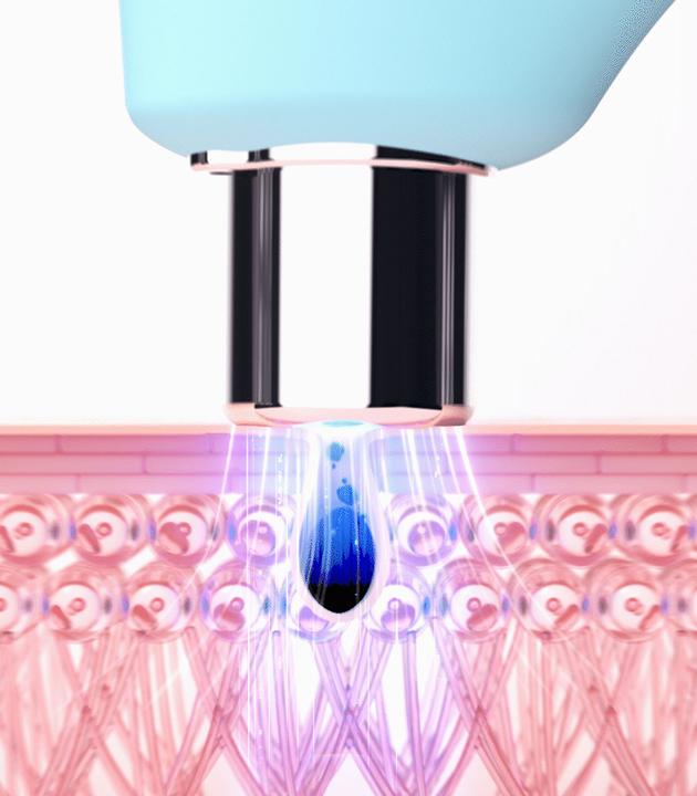 Produktbild Foreo Porinreiniger und LED-Lichtgerät