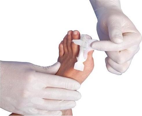 Actual product image 3M Tegaderm Foam HP Foam Compress Mini Cross adhesive 10 pcs.