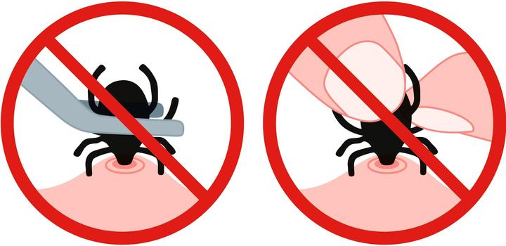 Produktbild TickSafe Rotierender Zeckengreifer