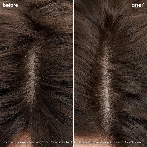 Actual product image Matrix Biolage Anti Dundruff Shampoo (250 ml, Liquid shampoo)