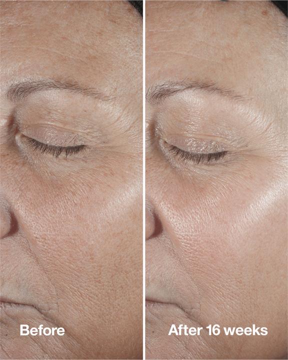 Produktbild Clinique Smart CliNight Repair Wrinkle Serum (75 ml)