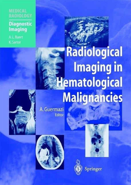 Produktbild Radiological Imaging in Hematological Malignancies (Ali Guermazi, 2012)