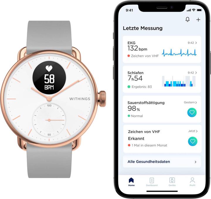 Produktbild Withings ScanWatch (38 mm)