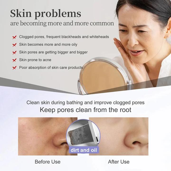Actual product image Anlan 01-ACPJ32-02A (white)