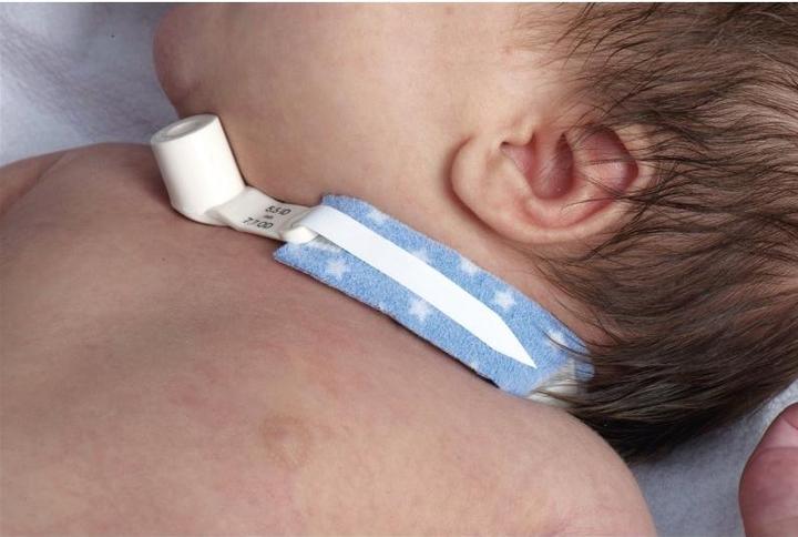 Immagine prodotto Dale Supporto per tubo tracheostomico Neonati 242