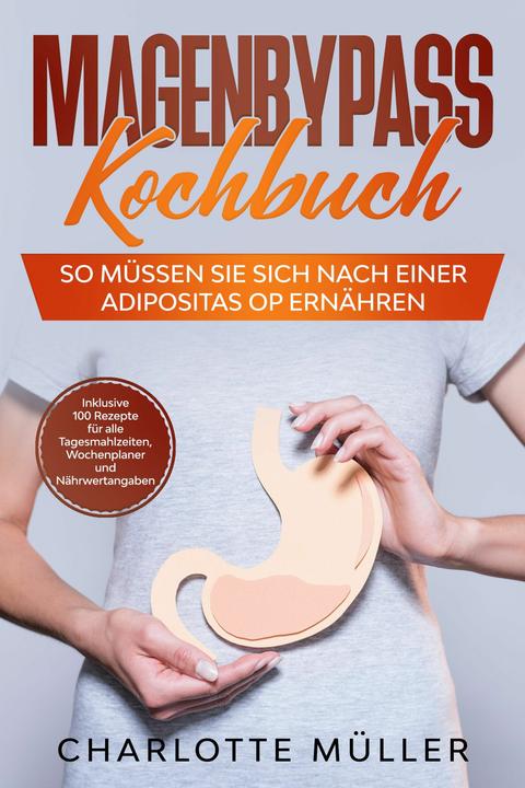 Actual product image Magenbypass Kochbuch: So müssen Sie sich nach einer Adipositas OP ernähren (German, Charlotte Miller, 2024)