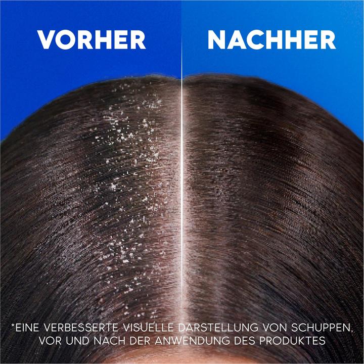 Image du produit Head & Shoulders Anti-Démangeaisons (500 ml, Shampoing liquide)