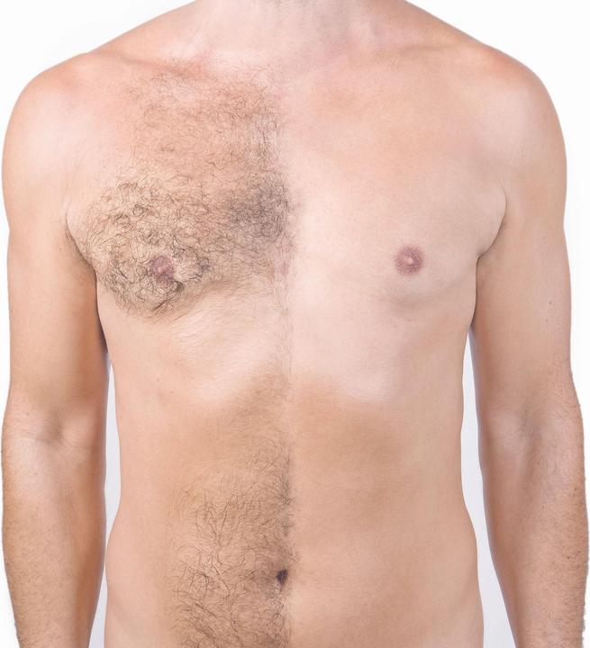 Actual product image Intome Hair Removal Powder (1 x, 70 g)