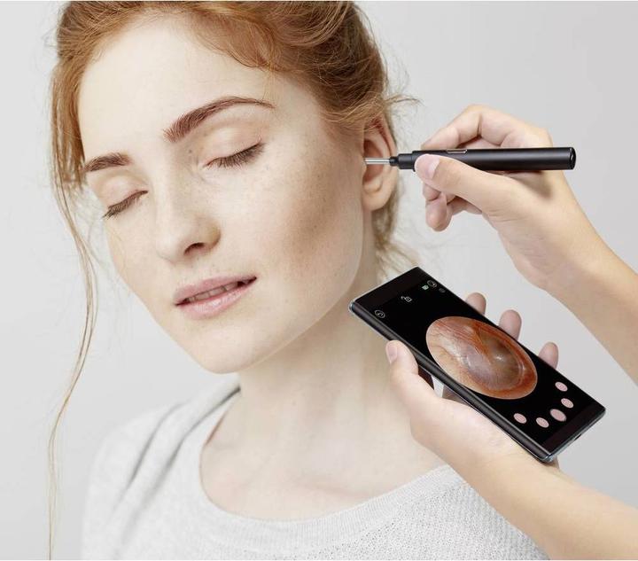 Image du produit Technaxx Otoscope (Auriculaire)
