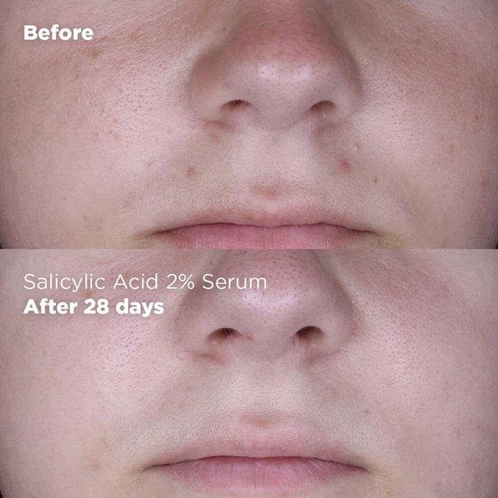 Immagine prodotto Skin Republic Acido salicilico 2% (30 ml)