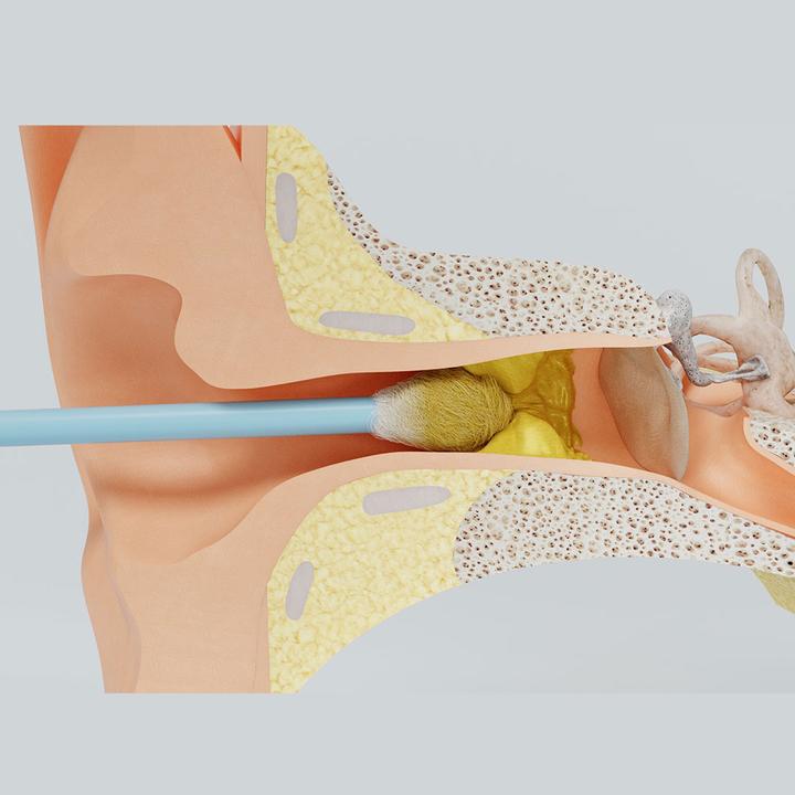 Actual product image ReUseMe Ear Cleaning Tool