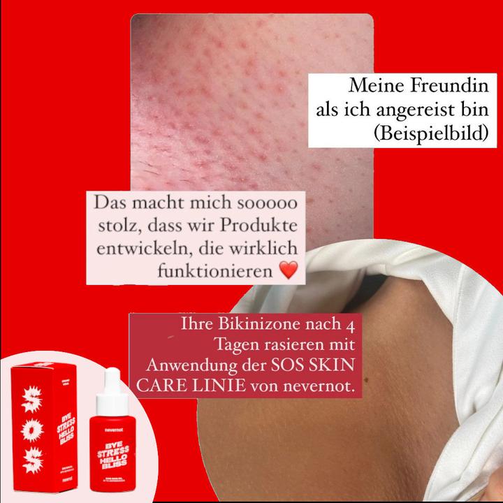 Produktbild NeverNot - SOS Skin Oil (30 ml, Intimöl)