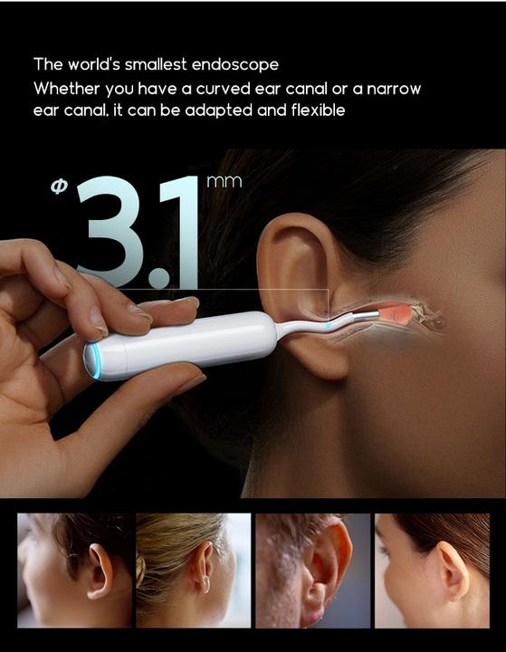 Actual product image Bebird Otoskop mit Ohrreinigungskamera