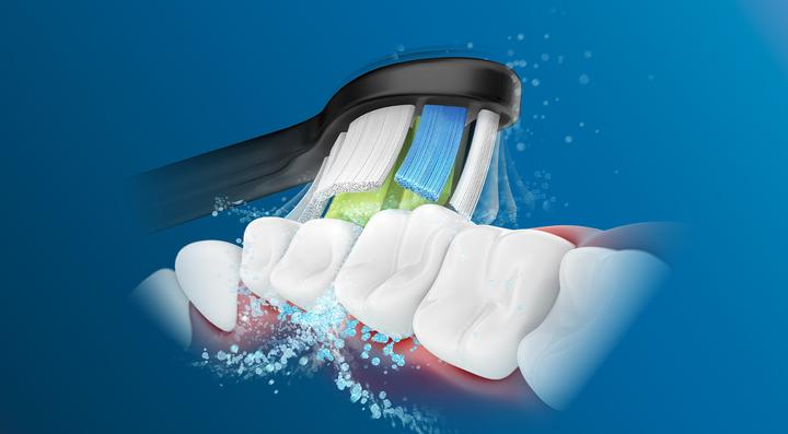 Actual product image Philips Sonicare W2 Optimal White (4 x)