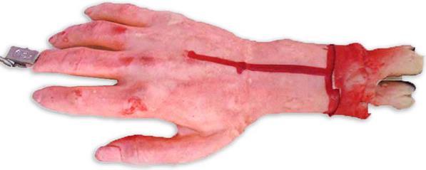 Produktbild Erfurth Blutende Hand