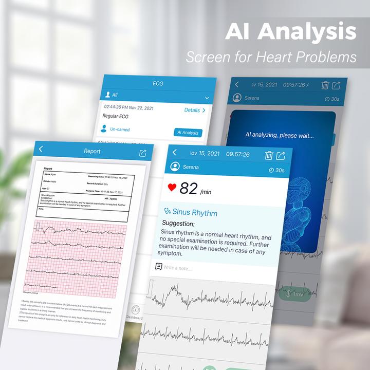 Produktbild ViatomTech BP2 Connect Wi-Fi upper arm bp monitor with ECG (Blutdruckmessgerät Oberarm)