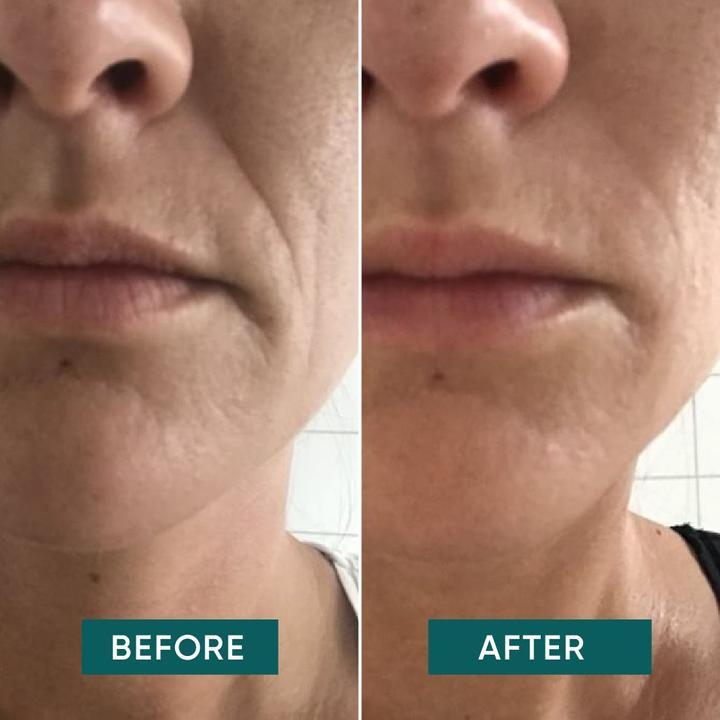 Actual product image Apricot - Wiederverw. Mund Pad Mit Hyaluron I Love Your Smile - 2 Stk.