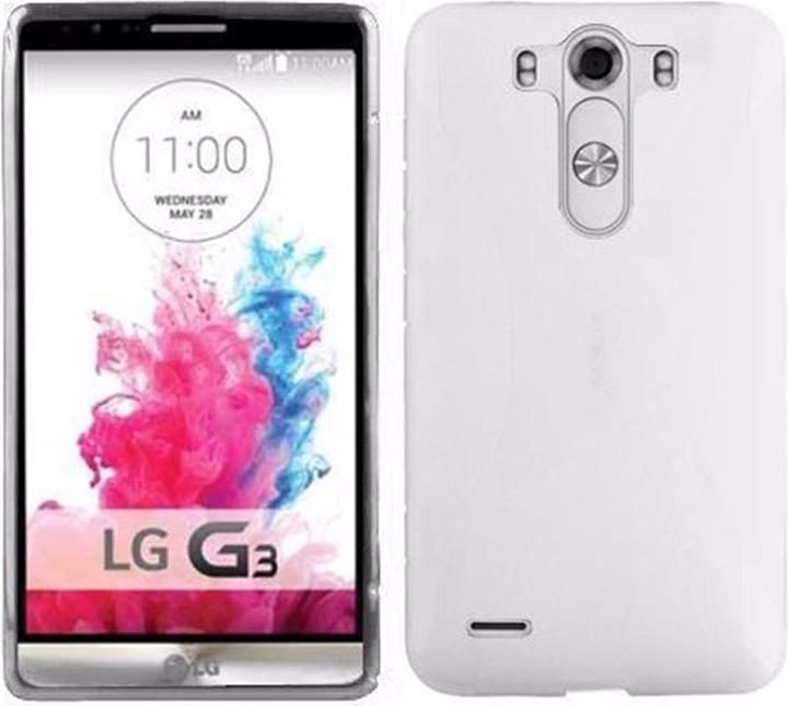 Image du produit Cadorabo TPU X-Line Cover (G3)
