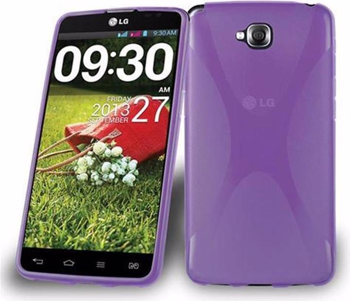 Produktbild Cadorabo TPU X-Line Cover (LG G Pad Pro Lite)