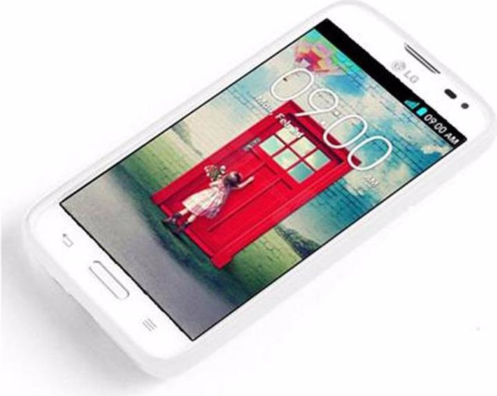 Actual product image Cadorabo TPU X-Line Cover (LG L70)