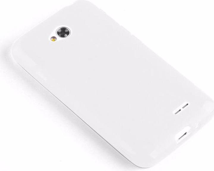 Actual product image Cadorabo TPU X-Line Cover (LG L70)