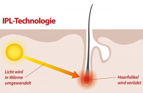 Image du produit Sichler Système d'épilation à la lumière pulsée