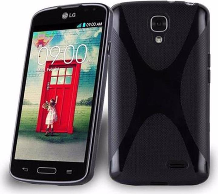 Actual product image Cadorabo TPU X-Line Cover (LG F70)