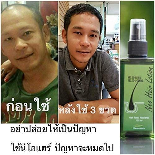 Produktbild Neo Haarwachstumsmittel (120 ml)
