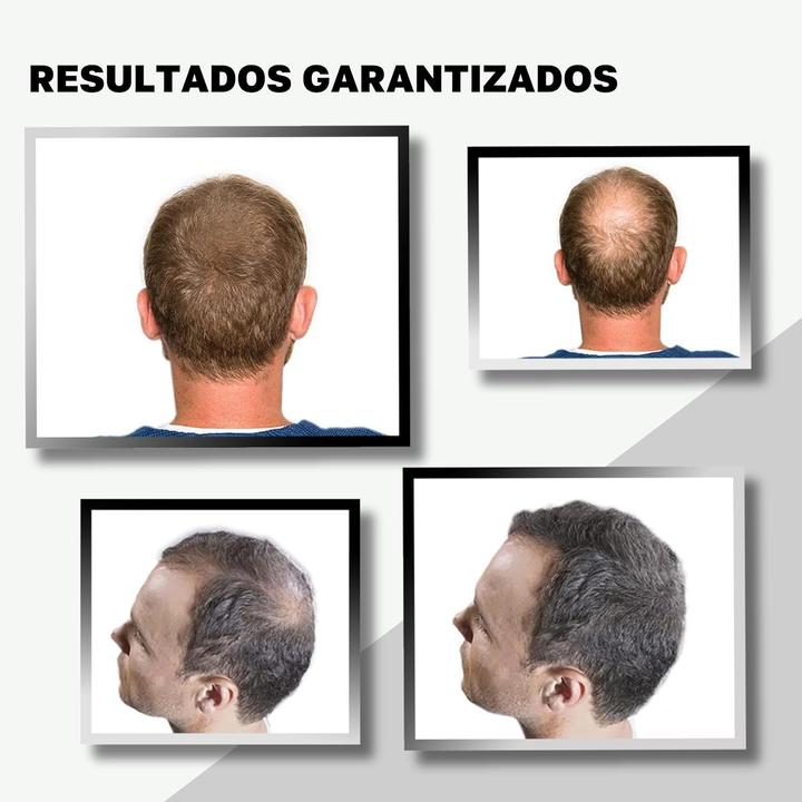Actual product image Vidal Schütthaar Ansatzpuder zur Haarverdichtung (Dark brown)