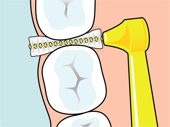 Produktbild TePe Interdentalbürsten Angle ISO 2 (6 x, 0.50 mm)