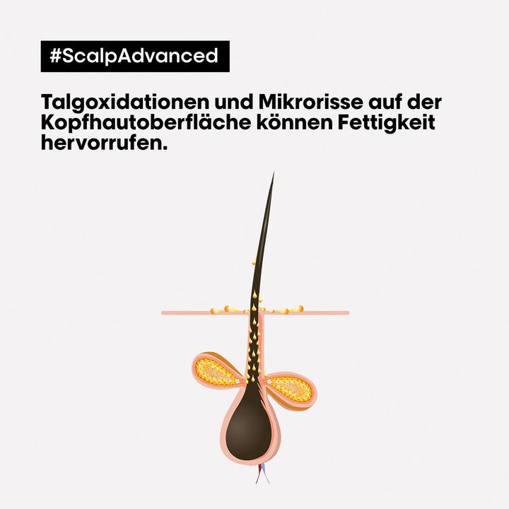 Produktbild L'Oréal Professionnel Scalp Advanced (250 ml)