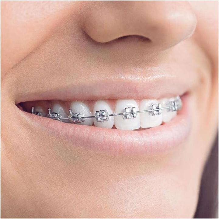 Productafbeelding Oral-B Tiener (Oscillerende tandenborstel)