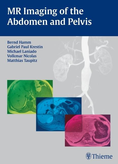 Immagine prodotto MR Imaging of the Abdomen and Pelvis (Inglese, Volkmar Nicolas, Matthias Taupitz, 2009)