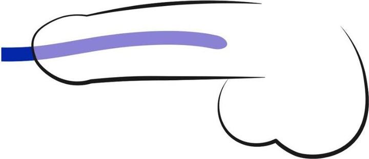 Actual product image You2Toys Dilator Set