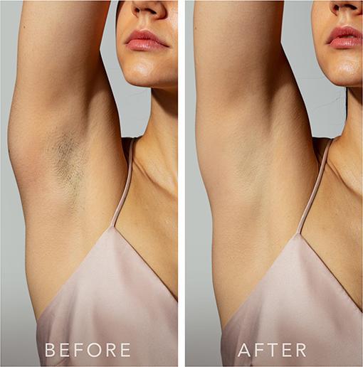 Image du produit Foreo Peach 2