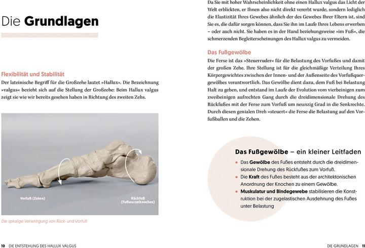 Image du produit Hallux Valgus - Nachhaltige Hilfe ohne OP (Allemand, Rogall, Thomas, 2024)