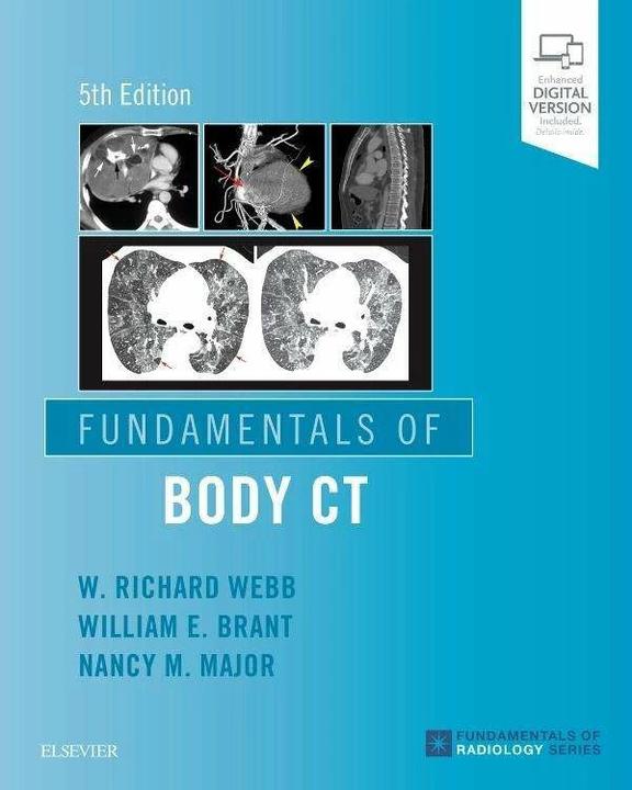 Immagine prodotto Fundamentals of Body Ct (Inglese, W. Richard Webb, Nancy M. Major, William E. Brant, 2019)