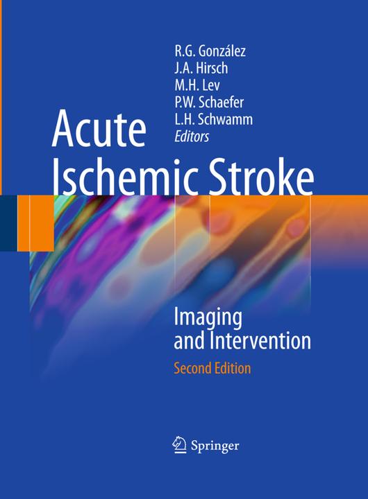 Image du produit Acute Ischemic Stroke (Anglais, Pamela W. Schaefer, R. Gilberto González, Michael H. Lev, Lee H. Éponge, Joshua A. Hirsch, 2014)
