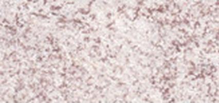 Immagine prodotto Dermacol Metallo 3D (2 Champagne)