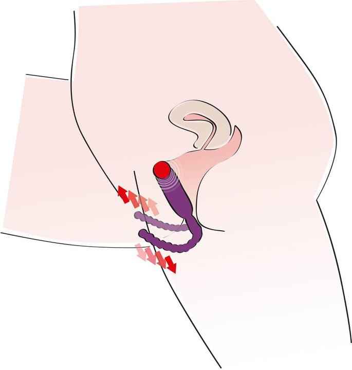 Produktbild You2Toys Intimate Spreader Vibrating
