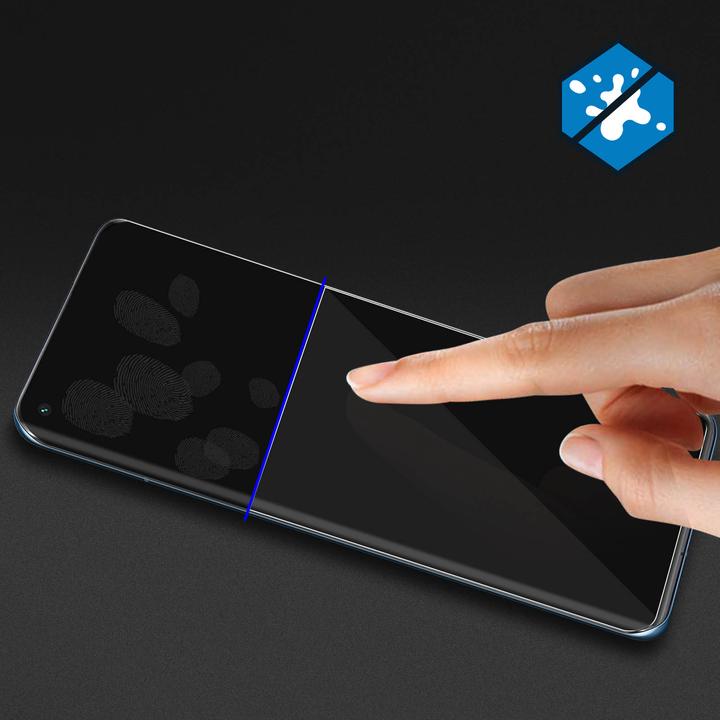 Actual product image Avizar Latex display protection film (1 Piece, Xiaomi Mi 11 Pro)