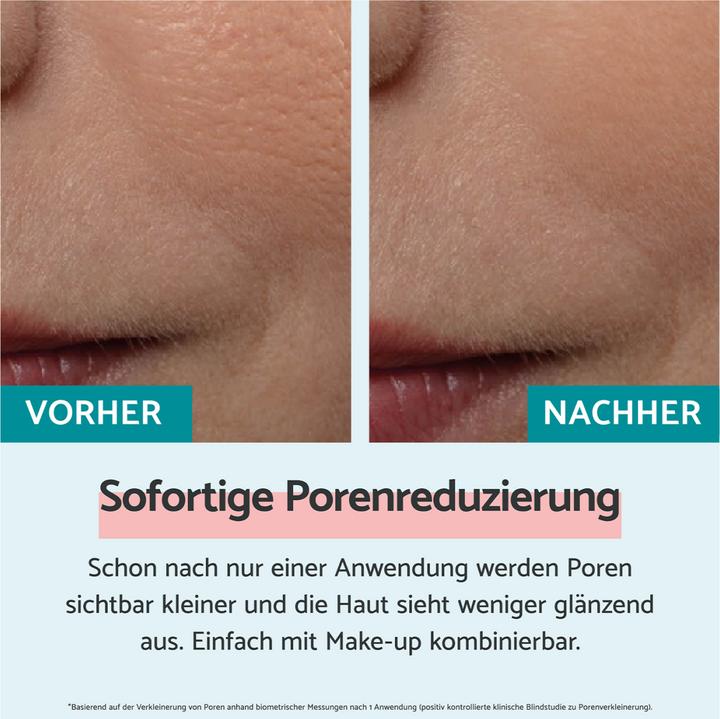 Produktbild Remescar Sofortige Porenreduzierung (20ml) (20 ml, Tagescreme)
