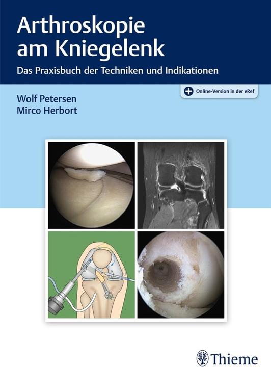Actual product image Petersen:Arthroskopie am Kniegelenk (German, 2020)