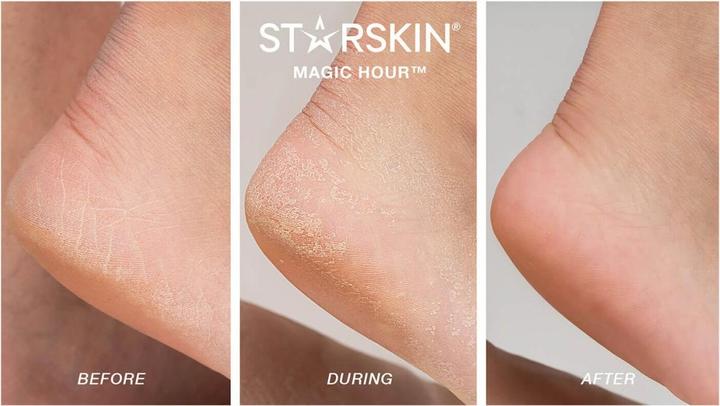 Image du produit Starskin - Masque exfoliant pour les pieds Magic Hour (Masque de pied, 1 ml)