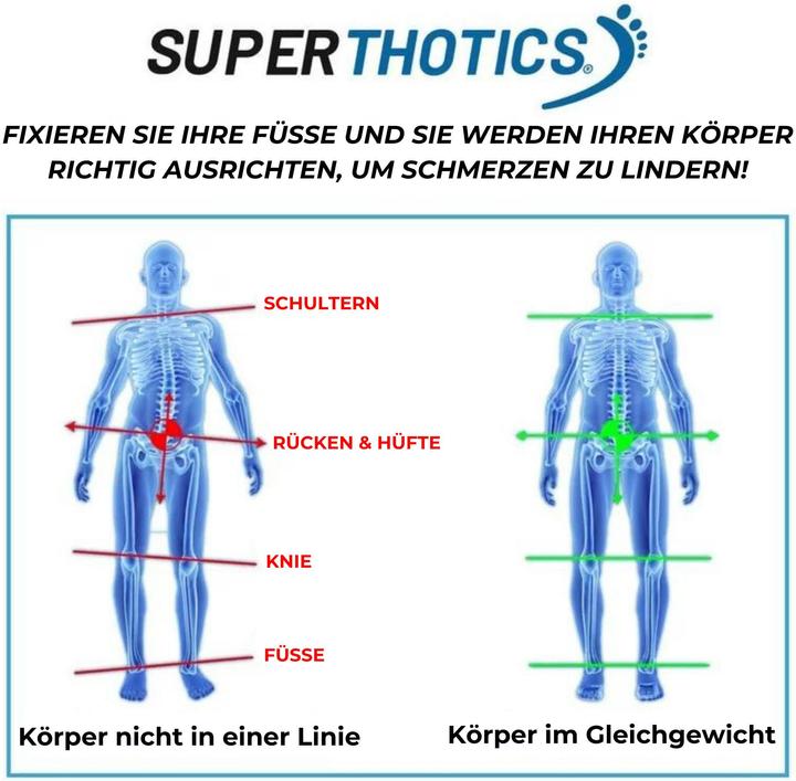 Actual product image Superthotics 