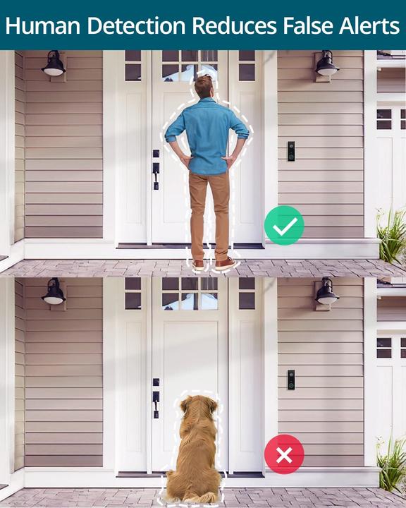 Immagine prodotto Aosu Campanello con telecamera (WiFi)