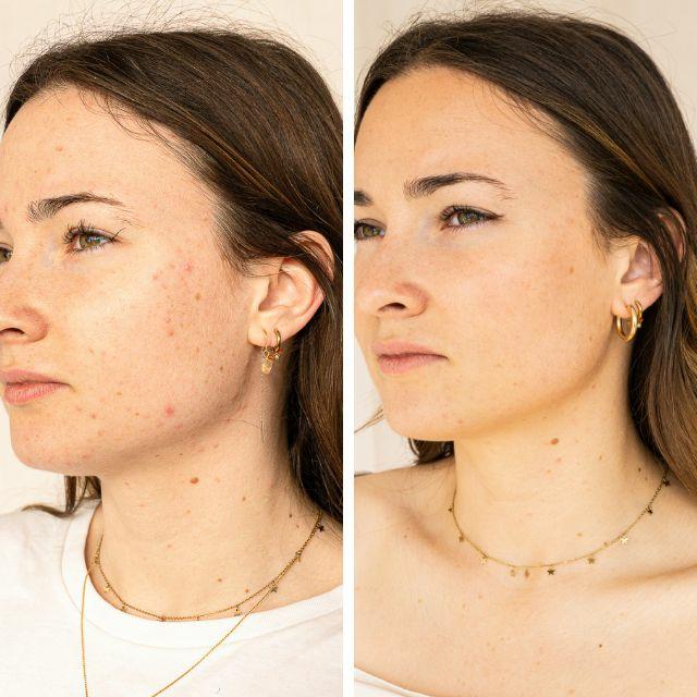 Actual product image Endro Natural serum against impurities (30 ml)