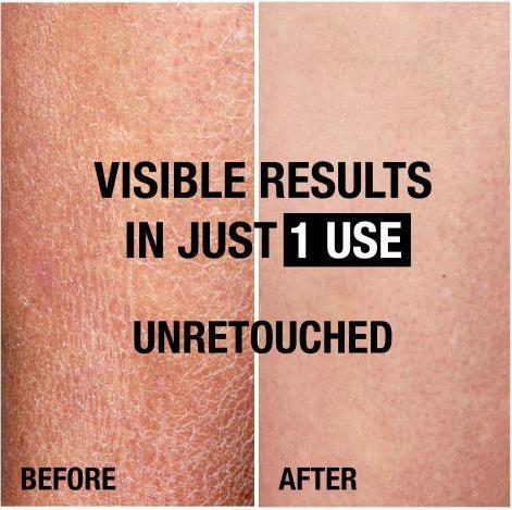 Image du produit Neutrogena Norwegian FormulaÂ® Visibly Renew (Lotion pour le corps, 400 ml)